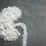 Kidney stones and the role of diet